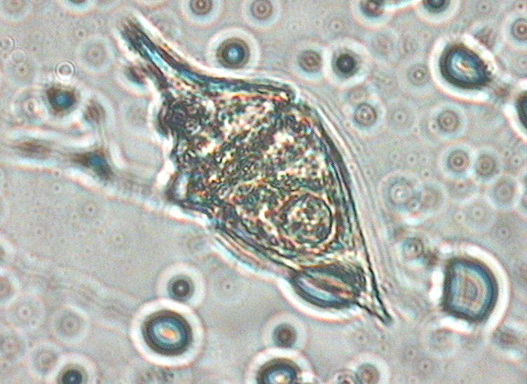 Dictyocha speculum